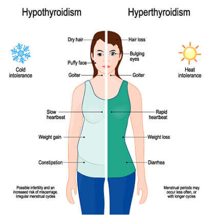 Thyroid Disorder Symptoms